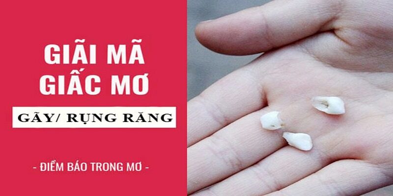 Giải mã giấc mơ rụng răng chi tiết và đầy đủ nhất